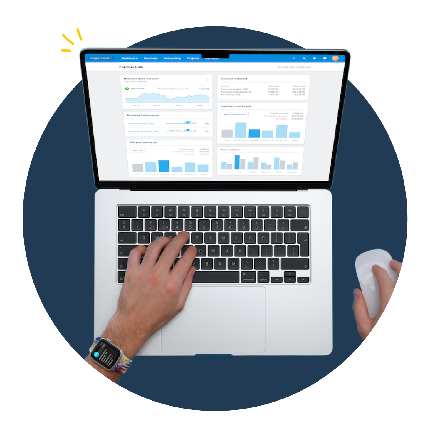 A pair of hands on a laptop showing the Xero dashboard.